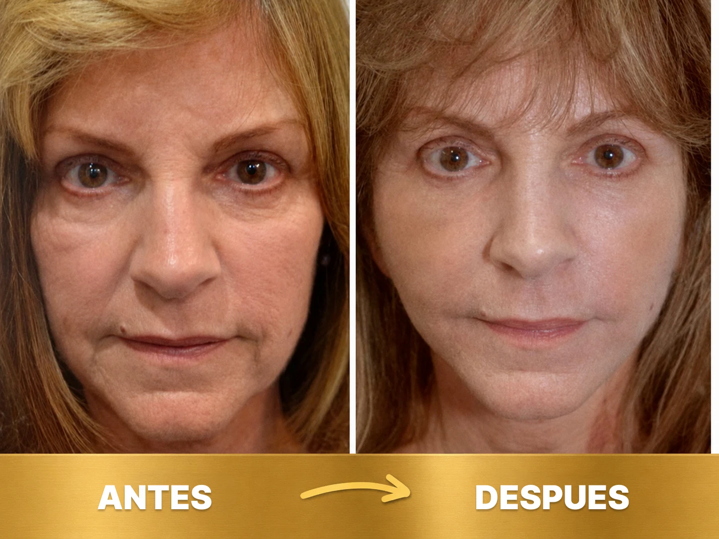 Antes y después 2