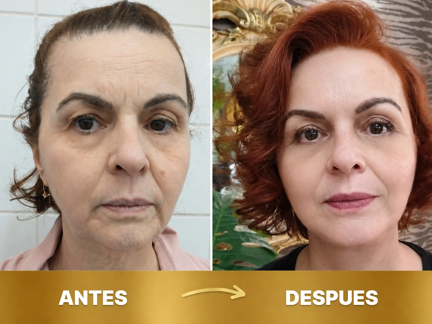 Antes y después 3