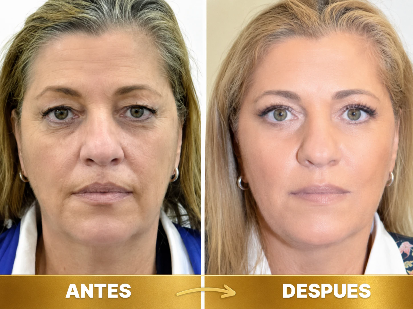 Antes y después 4